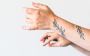 Advanced Tattoo Removal in Cardiff with Vale Laser 