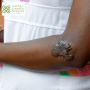 Effective Treatment for Keloids in Ghana – Book Now at CCS G