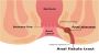 The Best Homeopathic Treatment For Asthma 