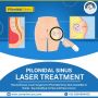 Best Pilonidal Sinus Laser Treatment in Noida