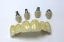 Aesthetics Zirconia Crown in China