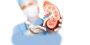 Kidney Stone Hospital in Jaipur