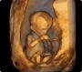 Baby Advanced Imaging Ultrasound near Boston MA