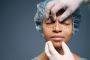 Rinoplastia Recife: Transforme Seu Visual com Segurança