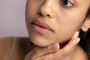 Treat Uneven Skin Tone in Jacksonville