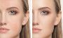 Transform Your Look with Venus Legacy Skin Tightening