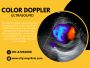 Colour Doppler Test Price: Cost, Factors & Savings