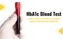 What is the HbA1c Blood Test? Everything You Need to Know Ab