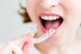 Affordable Braces Adults Love for Stunning Straight Smiles