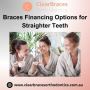 Braces Financing Options Affordable Solutions for Straighter