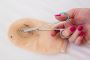 Buy Colostomy Bags Online – Affordable and Reliable