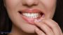 Advanced Gum Disease Treatment for Healthier Gums Advanced Gum Disease Treatment for Healthier Gums
