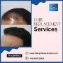 Hair Replacement in Bangalore | Hair Replacement center