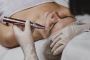 Exosome Micro Needling Facial for Skin Rejuvenation