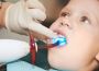 Cavity Prevention Made Easy with Tooth Sealants in Arlington