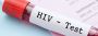 The Importance of Rapid HIV Testing Singapore