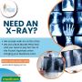 Need an X-ray? Visit us at Butler Medical Imaging for fast, 