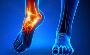 Sports Injury Surgery Naples FL