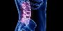 Most Trusted Spine Surgery in Naples, FL