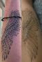 Picosure Laser Tattoo Removal Services