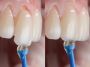 Best Cosmetic Dentistry in City of London Best Cosmetic Dentistry in City of London
