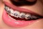 Best Dental Clinic In Park Street