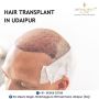 Hair Fall  Treatment in udaipur