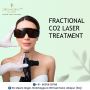 fractional co2 laser treatment in Udaipur
