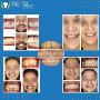 Get a Perfect Smile with Cosmetic Dentist in Gurgaon