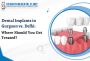 Best Dental Implants in Gurgaon – Painless & Permanent