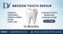 Broken Tooth Repair in Benalla