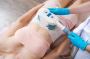 Cryolipolysis Treatment in Delhi - Non-Surgical Fat Freezing