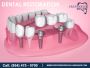 Preferred Dental Care: Premier Dental Restoration Services