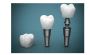 Dr. Bobby's Orthodontics and Dental Speciality Care