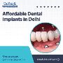 Affordable Dental Implants in Delhi