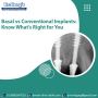 Basal vs Conventional Implants: Know What’s Right for You