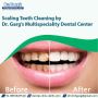 Scaling Teeth Cleaning by Dr. Garg’s Multispeciality Dental 