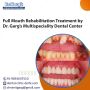Full Mouth Rehabilitation Treatment:Dr. Garg’s Dental Center