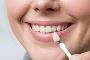 Affordable Dental Veneers | Tower House Dental Clinic