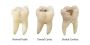 Teeth Whitening Glendale – Brighten Your Smile with Safe, Ef