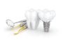 Best Dental Implants in Gurgaon