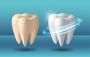 Cost of Teeth whitening in Gurgaon