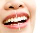 Mumbai Smile Makeover – Quick & Safe Whitening
