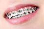 Best Implantology Specialist in Vizag  | Best Orthodontics &