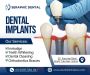 Restore Your Smile with the Best Dental Implants in Indore