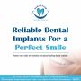 Advanced Dental Implants Solutions at Dentistium, Ahmedabad