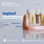 Best Implant Specialist in Nashik Top Implant Doctor Near