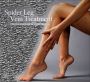 Safe and Effective Spider Vein Removal in Montreal