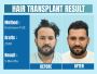 Why Celebrities Choose Dermalife Clinic
