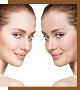Fungal Acne Treatment in Hyderabad - Dermiq Clinic 